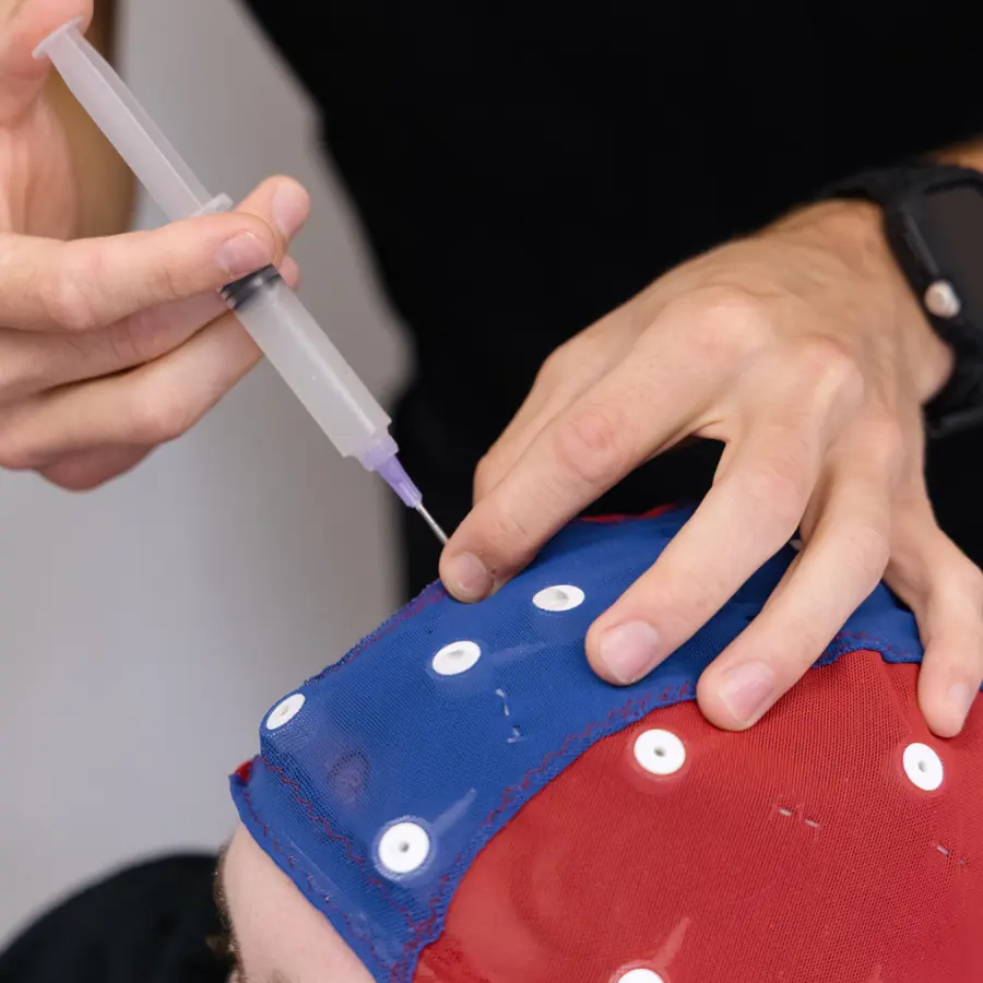 Clinician using a syringe to add gel to an electrode on an EEG cap